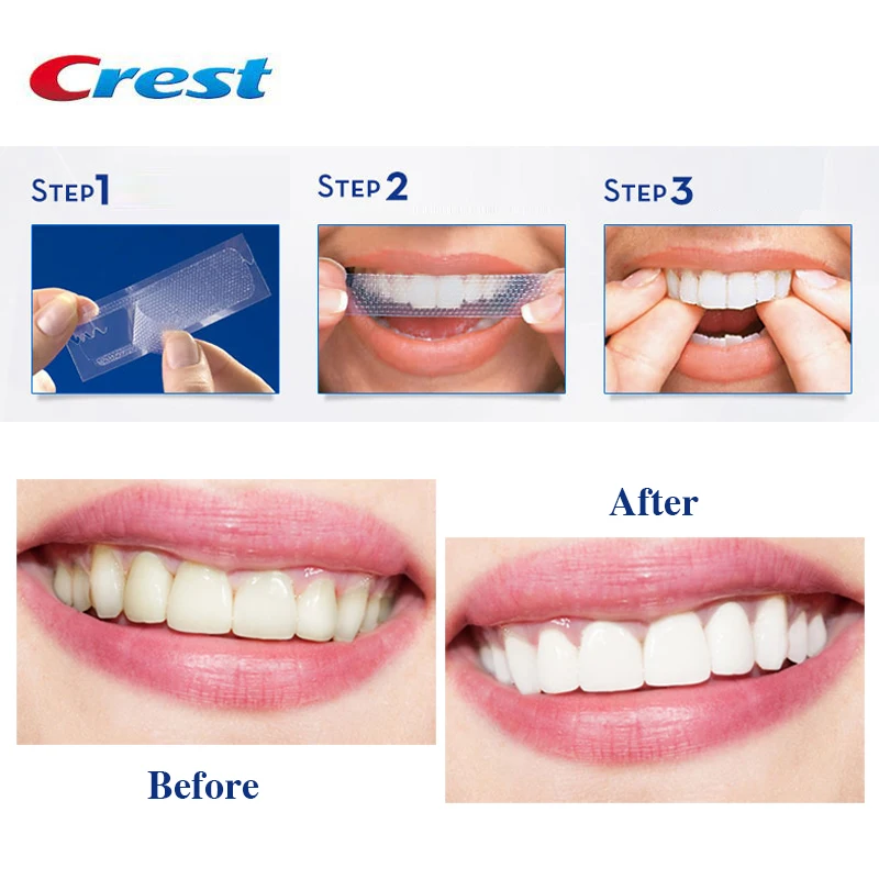 crest glamorous whitening strips