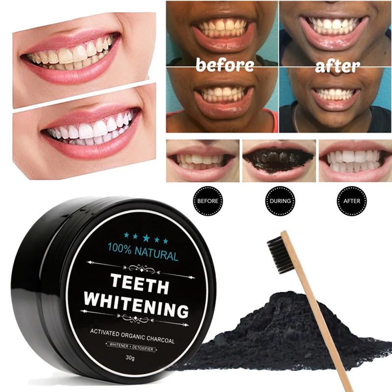 coal teeth whitening