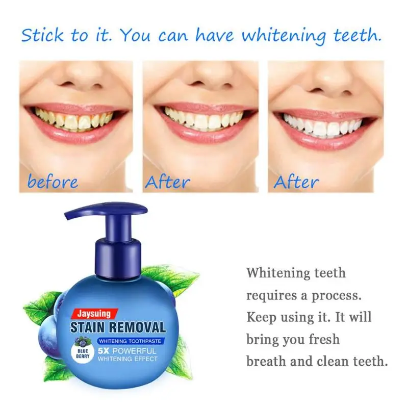 baking soda and toothpaste for whitening teeth