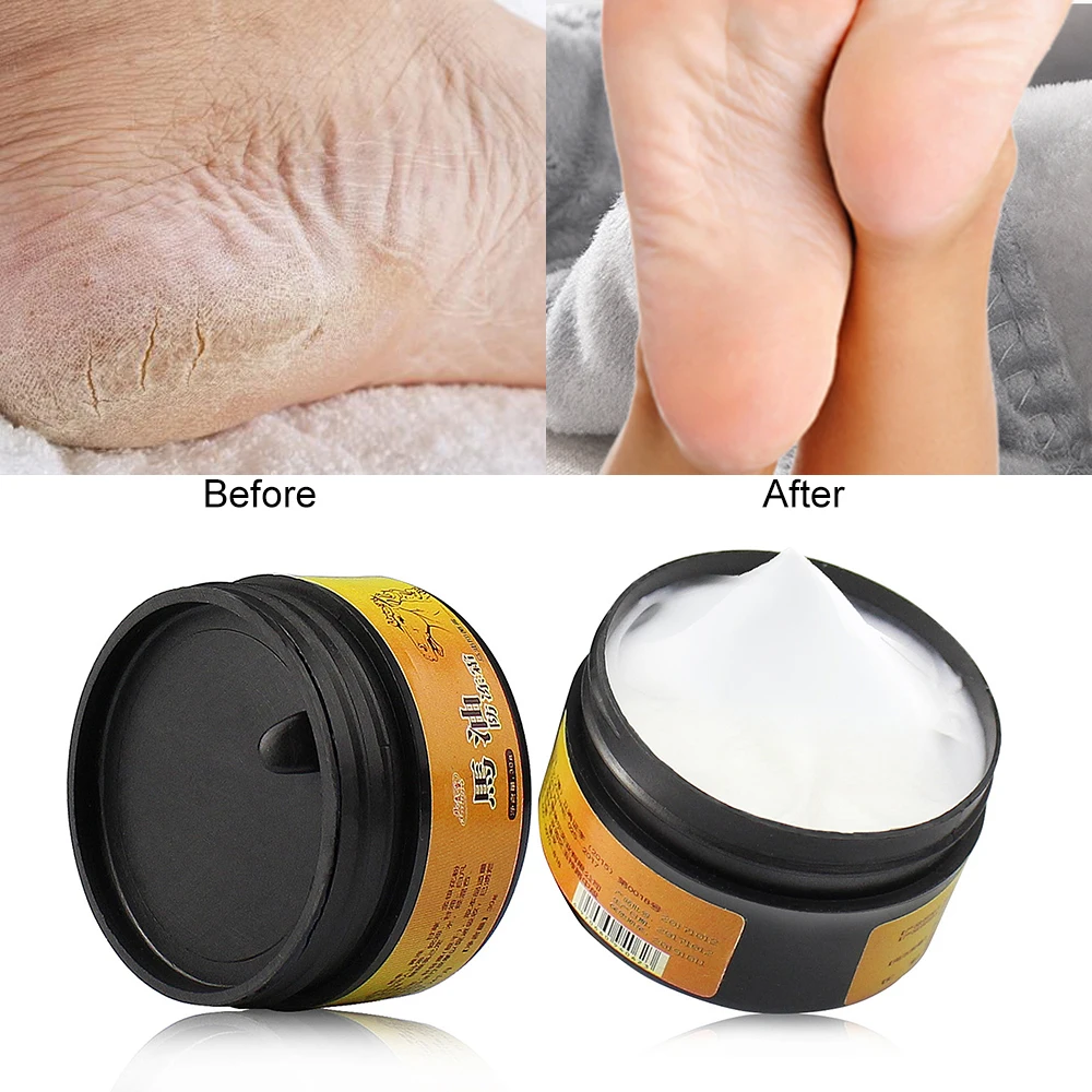 https://ae05.alicdn.com/kf/Hbc47e67dee1947cea919df9fbd74d283P/1pc-Horse-Oil-Feet-Cream-Heel-Cream-for-Athlete-s-Foot-Feet-Mask-Itch-Blisters-Anti.jpg