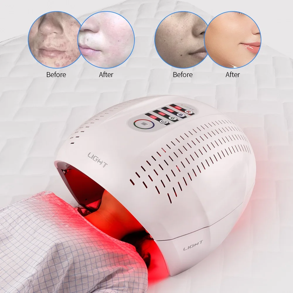 light therapy lamp for acne