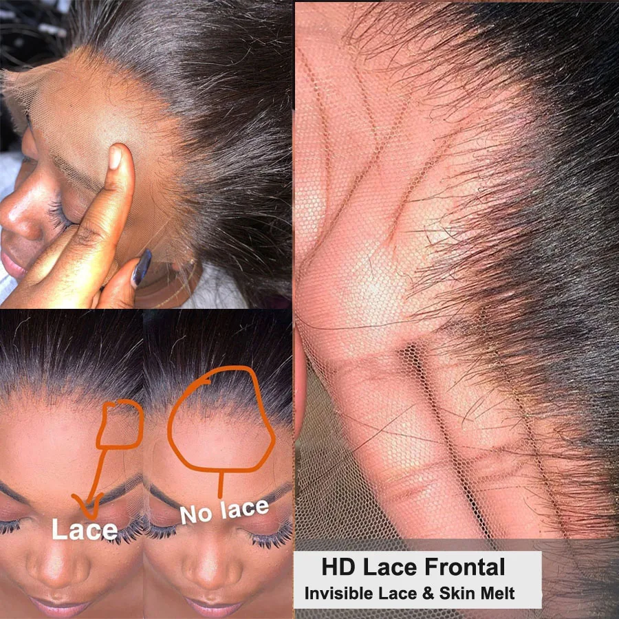 lace frontal vs lace closure