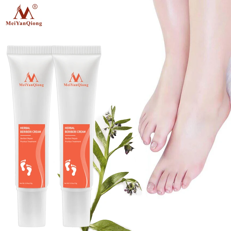 Herbal Foot Treatment Anti Fungal Infection Onychomycosis Paronychia