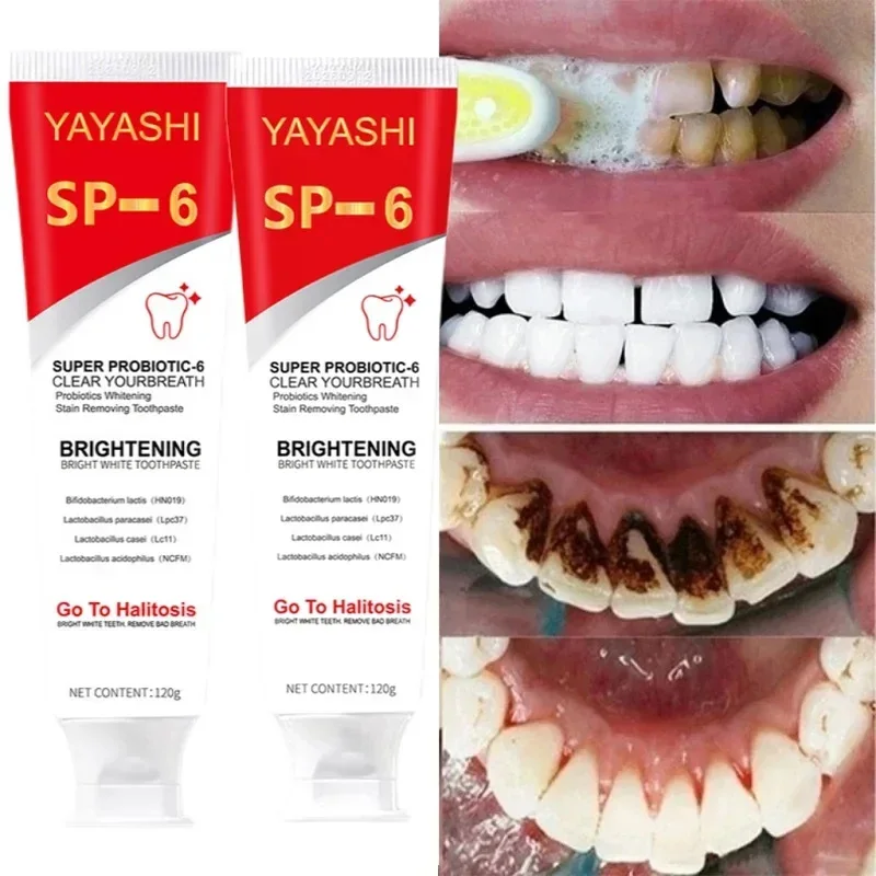 SP-6 Whitening Tooth Remove Plaque Stains Probiotic Toothpaste Teeth Whitener Oral Hygiene Clean Fresh Breath Denta 120g-animated-img