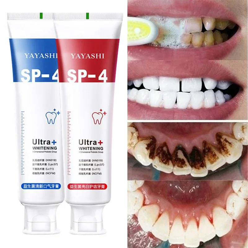 120g Probiotic Toothpaste Remove Plaque Stains Teeth Whitener Sp-4 Whitening Tooth Oral Hygiene Clean Fresh Breath Dental Tools-animated-img