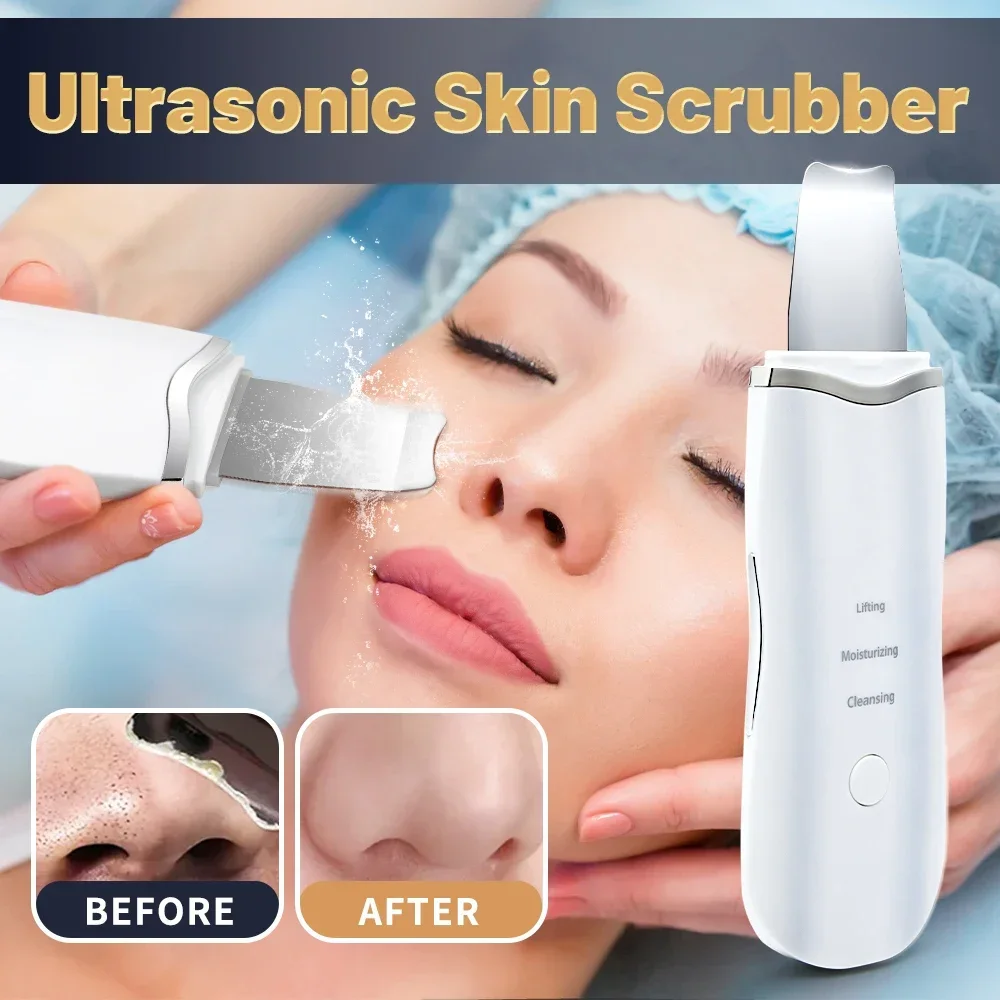 Professional No Ultrasonic Facial Skin Scrubber Ion Deep Face Cleaning Peeling Rechargeable Skin Care Device Beauty Instrument-animated-img