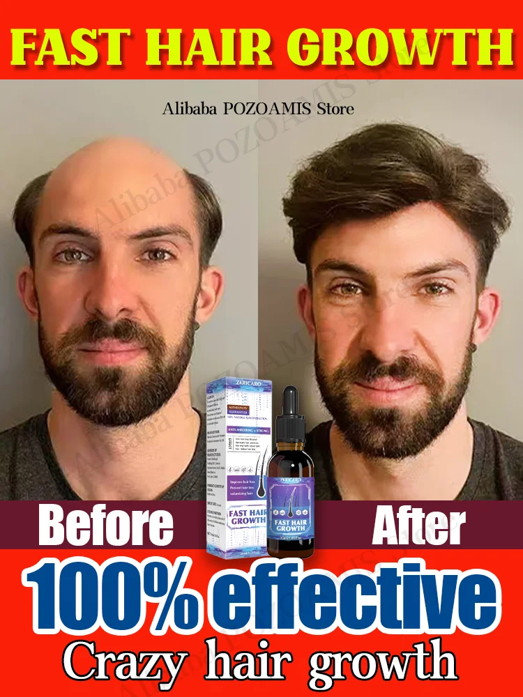 98% of buyers buy again, have more and more hair, say goodbye to baldness, thick hair,Hot selling product-animated-img