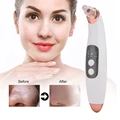 טיפול פנים שלם במכשיר 1 מכשיר איכותי לשאיבת ראשים שחורים ולכלוך מהפנים  preview-3